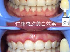 -Dr.Z dental仁康种植矫正中心
