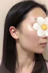 -广州美莱医疗美容医院