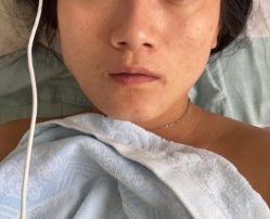 点击看大图 体验后-天津伊美尔医疗整形美容专科医院