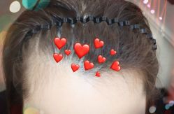 -大麦微针植发全国连锁