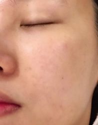 -安徽合肥韩美整形外科医院