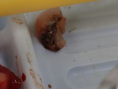 -中国人民解放军总医院第三医学中心