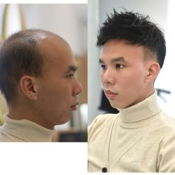 -发饰美男士增发补发假发定制店