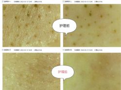 点击看大图 -东森自然美.INDIBA.美容SPA.皮肤管理