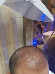 -碧莲盛·不剃发植发