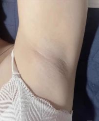 -薇兰专业脱毛连锁机构