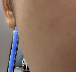 -美瑞莎创美医疗美容