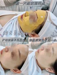 -skin79皮肤管理中心