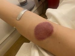 -紫琪尔胸部养护中心