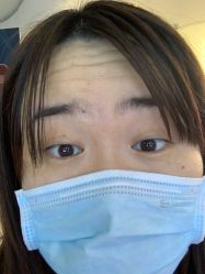 体验前-深圳美莱医疗美容医院