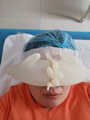 -天津健丽·去眼袋医疗美容机构