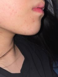 -万州华美紫馨整形美容医院