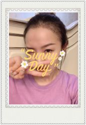 -大麦微针植发全国连锁