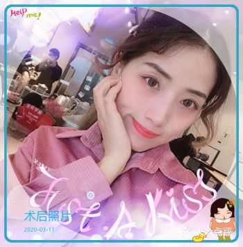 咬肌肥大怎么办!打瘦脸针呀!