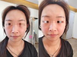 -颜和骨正·明哲式骨相美学整骨