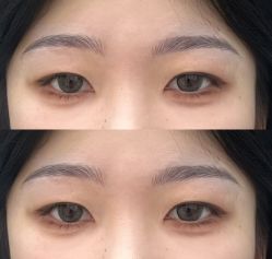 -Doris多里斯半永久纹眉·SMP纹发·发际线