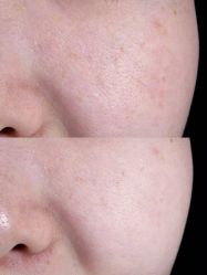 -和颜一美轻医美连锁