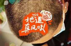 -大麦微针植发全国连锁