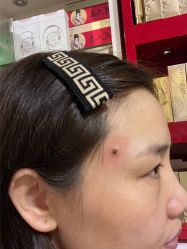 -北京美痣堂古方祛痣斑疣瘊
