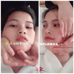 -SEAS小顏·日本小颜整骨美容サロン