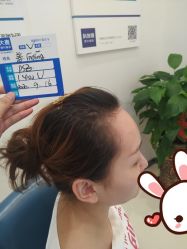 点击看大图 -大麦微针植发丨全国连锁