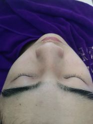 -蕾特恩专业祛痘国际连锁