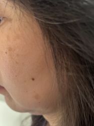 -广州美莱医疗美容医院