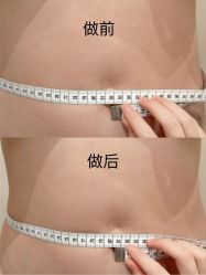 -Fundi张玉珊修身堂·indiba·BTL科技瘦身