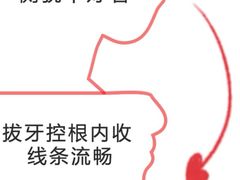 -深圳佑诺口腔门诊部