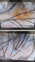 -侗秀养发•头疗