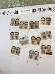 -菊子小颜·日式整骨·产后管理