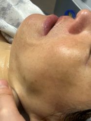 -长沙雅美医疗美容医院