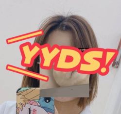 -大麦微针植发丨全国连锁