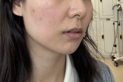 体验前-恒妍医美·韩国定制抗衰中心