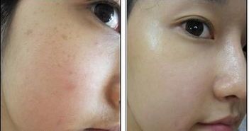 -SKINIST丽铂医疗美容