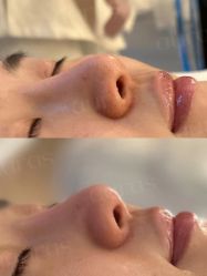 点击看大图 -AURAS璈然科技护肤中心