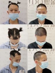 -熙朵美学植发连锁