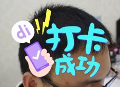 -大麦微针植发全国连锁