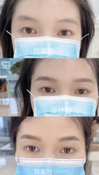 -久匠半永久纹眉