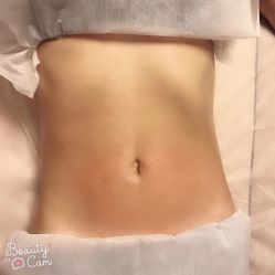 -纤济美·减重塑形