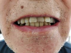 -极光口腔·矫正种植修复(锦江院区)