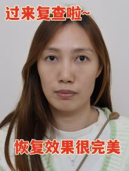 -广州健丽·去眼袋医疗美容机构