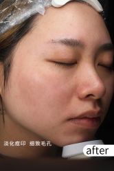 -Yestar宁波艺星整形医院