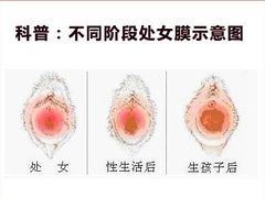 -成都恒博医院·全科检查