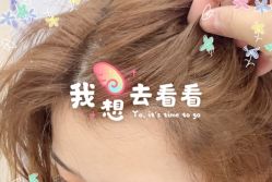 -大麦微针植发全国连锁