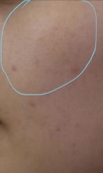 -南宁华美医疗美容医院