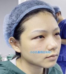 -天津健丽·去眼袋医疗美容机构