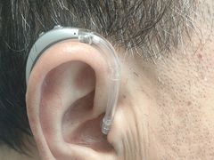 -海之声助听器无锡旗舰中心·儿童验配中心