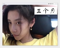 -大麦微针植发全国连锁