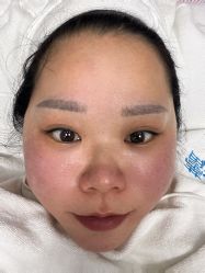 -蕾特恩专业祛痘国际连锁